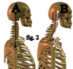 Forard Head Compariion