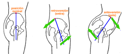 Anteversion and retroversion